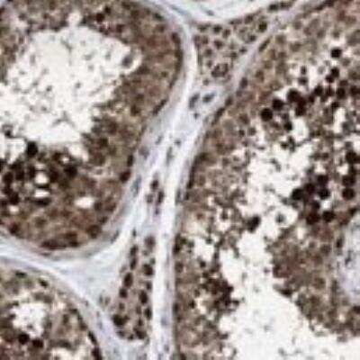 Immunohistochemistry: Cyclin A1 Antibody [28970002] - Most of the normal tissues displayed strong cytoplasmic and/or nuclear positivity. Malignant tissues exhibited moderate cytoplasmic and occasional nuclear immunoreactivity. Several thyroid and liver cancers and a few cases of colo-rectal, ovarian and renal cancers showed strong staining.  Image and statement courtesy of the Human Protein Atlas (HPA).