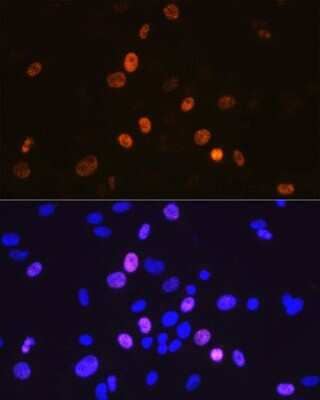 Immunocytochemistry/Immunofluorescence: Cyclin A2 Antibody (3E9Z3) [NBP3-15625] - Immunofluorescence analysis of C6 cells using Cyclin A2 Rabbit mAb (NBP3-15625) at dilution of 1:100 (40x lens). Blue: DAPI for nuclear staining.