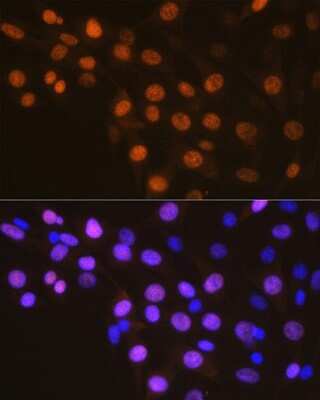 Immunocytochemistry/Immunofluorescence: Cyclin A2 Antibody (3E9Z3) [NBP3-15625] - Immunofluorescence analysis of NIH-3T3 cells using Cyclin A2 Rabbit mAb (NBP3-15625) at dilution of 1:100 (40x lens). Blue: DAPI for nuclear staining.