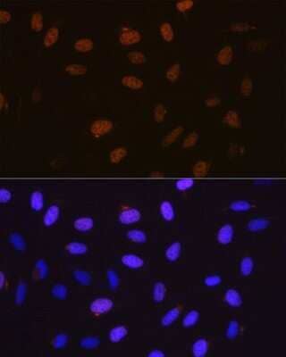 Immunocytochemistry/Immunofluorescence: Cyclin A2 Antibody (3E9Z3) [NBP3-15625] - Immunofluorescence analysis of U-2 OS cells using Cyclin A2 Rabbit mAb (NBP3-15625) at dilution of 1:100 (40x lens). Blue: DAPI for nuclear staining.