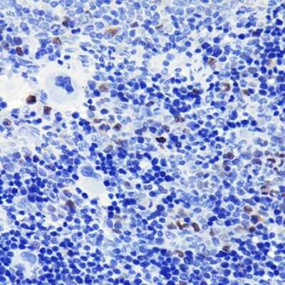 Immunohistochemistry-Paraffin: Cyclin A2 Antibody (3E9Z3) [NBP3-15625] - Immunohistochemistry of paraffin-embedded rat spleen using Cyclin A2 Rabbit mAb (NBP3-15625) at dilution of 1:100 (40x lens).Perform microwave antigen retrieval with 10 mM PBS buffer pH 7.2 before commencing with IHC staining protocol.