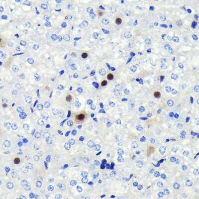 Immunohistochemistry-Paraffin: Cyclin A2 Antibody (3E9Z3) [NBP3-15625] - Immunohistochemistry of paraffin-embedded mouse liver using Cyclin A2 Rabbit mAb (NBP3-15625) at dilution of 1:100 (40x lens).Perform microwave antigen retrieval with 10 mM PBS buffer pH 7.2 before commencing with IHC staining protocol.