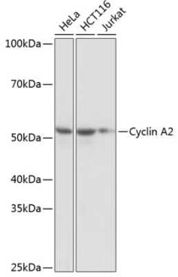 Western Blot: Cyclin A2 Antibody (3E9Z3) [NBP3-15625] - Western blot analysis of extracts of various cell lines, using Cyclin A2 antibody (NBP3-15625) at 1:1000 dilution. Secondary antibody: HRP Goat Anti-Rabbit IgG (H+L) at 1:10000 dilution. Lysates/proteins: 25ug per lane. Blocking buffer: 3% nonfat dry milk in TBST. Detection: ECL Basic Kit. Exposure time: 1s.