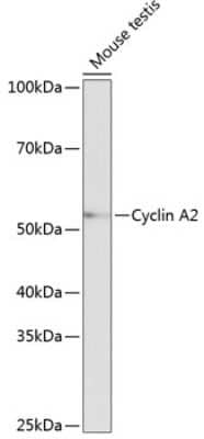 Western Blot: Cyclin A2 Antibody (3E9Z3) [NBP3-15625] - Western blot analysis of extracts of Mouse testis, using Cyclin A2 antibody (NBP3-15625) at 1:1000 dilution. Secondary antibody: HRP Goat Anti-Rabbit IgG (H+L) at 1:10000 dilution. Lysates/proteins: 25ug per lane. Blocking buffer: 3% nonfat dry milk in TBST. Detection: ECL Basic Kit. Exposure time: 10s.