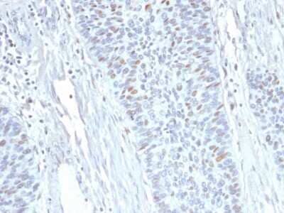 Immunohistochemistry-Paraffin: Cyclin A2 Antibody (E67) - Azide and BSA Free [NBP2-34613] - Formalin-fixed, paraffin-embedded human Endometrium stained with Cyclin A2 Antibody (E67).