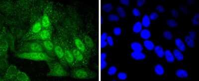Immunocytochemistry/Immunofluorescence: Cyclin A2 Antibody (SD2052) [NBP2-67754] - Staining Cyclin A2 in HepG2 cells (green). The nuclear counter stain is DAPI (blue). Cells were fixed in paraformaldehyde, permeabilised with 0.25% Triton X100/PBS.