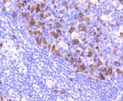 Immunohistochemistry-Paraffin: Cyclin A2 Antibody (SD2052) [NBP2-67754] - Analysis of paraffin-embedded human tonsil tissue using anti-Cyclin A2 antibody. Counter stained with hematoxylin.