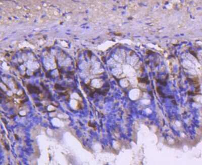 Immunohistochemistry-Paraffin: Cyclin A2 Antibody (SD2052) [NBP2-67754] - Analysis of paraffin-embedded mouse colon tissue using anti-Cyclin A2 antibody. Counter stained with hematoxylin.