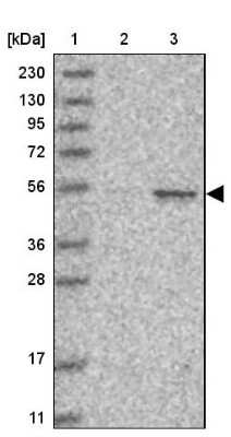 Western Blot: Cyclin A2 Antibody [NBP1-88156] - Lane 1: Marker  [kDa] 230, 130, 95, 72, 56, 36, 28, 17, 11.  Lane 2: Human cell line RT-4.  Lane 3: Human cell line U-251MG sp