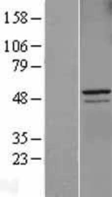 Western Blot: Cyclin A2 Overexpression Lysate (Adult Normal) [NBL1-08864] Left-Empty vector transfected control cell lysate (HEK293 cell lysate); Right -Over-expression Lysate for Cyclin A2.