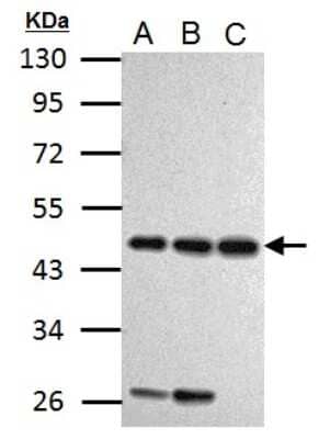 Western Blot: Cyclin Antibody [NBP2-16051] - Sample (30 ug of whole cell lysate) A: Jurkat B: Raji C: K562 10% SDS PAGE gel, diluted at 1:1000.