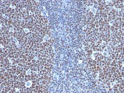 Immunohistochemistry-Paraffin: Cyclin B1 Antibody (SPM619) - IHC-Prediluted [NBP2-48126] - Human Tonsil stained with Cyclin B1 Monoclonal Antibody (SPM619)