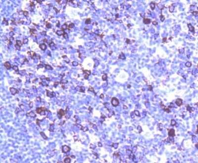Immunohistochemistry-Paraffin: Cyclin B1 Antibody (SU33-03) [NBP2-67464] - Analysis of paraffin-embedded human tonsil tissue using anti-Cyclin B1 antibody. Counter stained with hematoxylin.