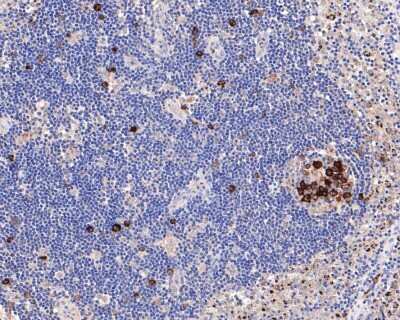Immunohistochemistry-Paraffin: Cyclin B1 Antibody (SU33-03) [NBP2-67464] - Analysis of paraffin-embedded human lymph nodes tissue with Rabbit anti-Cyclin B1 antibody washed with ddH2O and PBS, and then probed with the primary antibody  at 1/400 dilution for 1 hour at room temperature. The detection was performed using an HRP conjugated compact polymer system. DAB was used as the chromogen. Tissues were counterstained with hematoxylin and mounted with DPX.