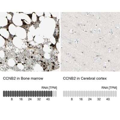 <b>Orthogonal Strategies Validation. </b>Immunohistochemistry-Paraffin: Cyclin B2 Antibody [NBP1-89657] - Staining in human bone marrow and cerebral cortex tissues using anti-CCNB2 antibody. Corresponding CCNB2 RNA-seq data are presented for the same tissues.