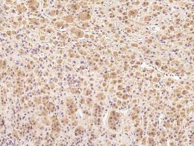 Immunohistochemistry-Paraffin: Cyclin B2 Antibody [NBP2-98961] - Immunochemical staining of human Cyclin B2 in human adrenal gland with rabbit polyclonal antibody at 1:300 dilution, formalin-fixed paraffin embedded sections.