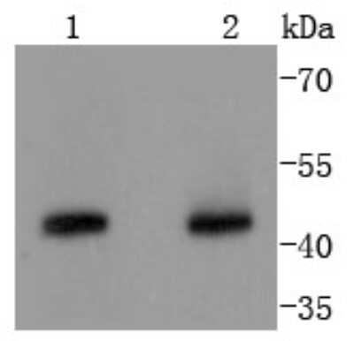 Western Blot: Cyclin B2 Antibody (SD2045) [NBP2-67749] - Analysis of Cyclin B2 on different lysates using anti-Cyclin B2 antibody at 1/1,000 dilution. Positive control: Lane 1: Hela Lane 2: K562