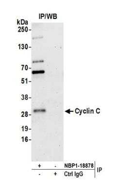 Immunoprecipitation: Cyclin C Antibody [NBP1-18878] - Detection of human Cyclin C by western blot of immunoprecipitates. Samples: Whole cell lysate (0.5 or 1.0 mg per IP reaction; 20% of IP loaded) from HeLa cells prepared using NETN lysis buffer. Antibodies: Affinity purified rabbit anti-Cyclin C antibody NBP1-18878 used for IP at 6 ug per reaction. For blotting immunoprecipitated Cyclin C, NBP1-18878 was used at 1 ug/ml. Detection: Chemiluminescence with an exposure time of 30 seconds.