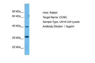 Western Blot: Cyclin C Antibody [NBP2-87234] - Host: Rabbit. Target Name: CCNC. Sample Tissue: Human LN18 Whole Cell lysates. Antibody Dilution: 1ug/ml