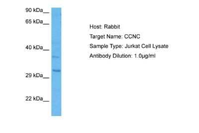 Western Blot: Cyclin C Antibody [NBP2-87235] - Host: Rabbit. Target Name: CCNC. Sample Tissue: Human Jurkat Whole Cell lysates. Antibody Dilution: 1ug/ml