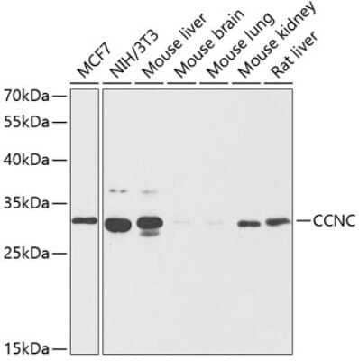 Western Blot: Cyclin C Antibody [NBP2-92617] - Analysis of extracts of various cell lines, using Cyclin C at 1:1000 dilution.Secondary antibody: HRP Goat Anti-Rabbit IgG (H+L) at 1:10000 dilution.Lysates/proteins: 25ug per lane.Blocking buffer: 3% nonfat dry milk in TBST.Detection: ECL Basic Kit .Exposure time: 60s.
