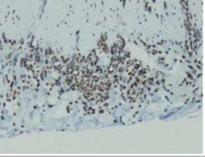 Immunohistochemistry-Paraffin: Cyclin D1 Antibody (E16-I) [NBP1-79012] - Intestinal Mantle-Cell Lymphoma showing nuclear cyclin D1 positivity. Formalin fixed, paraffin embedded human tissue (4 um section) stained with anti-cyclin D1 monospecific clonal antibody.