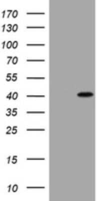 Western Blot: Cyclin D1 Antibody (OTI1G2) - Azide and BSA Free [NBP2-70244] - Analysis of HEK293T cells were transfected with the pCMV6-ENTRY control (Left lane) or pCMV6-ENTRY Cyclin D1.