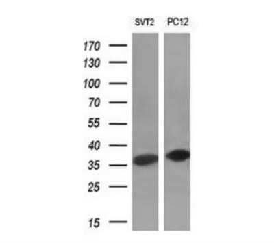 Western Blot: Cyclin D1 Antibody (OTI1G2) - Azide and BSA Free [NBP2-70244] - Analysis of extracts (10ug) from 2 different cell lines by using anti-CCND1 monoclonal antibody.(1:200)