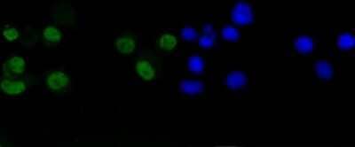 Immunocytochemistry/Immunofluorescence: Cyclin D1 Antibody (SA38-08) [NBP2-67306] - Staining Cyclin D1 in N2A cells (green). The nuclear counter stain is DAPI (blue). Cells were fixed in paraformaldehyde, permeabilised with 0.25% Triton X100/PBS.
