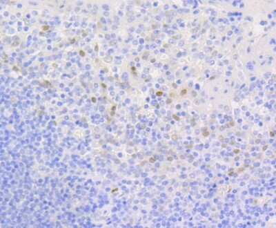 Immunohistochemistry-Paraffin: Cyclin D1 Antibody (SA38-08) [NBP2-67306] - Analysis of paraffin-embedded human tonsil tissue using anti-Cyclin D1 antibody. Counter stained with hematoxylin.