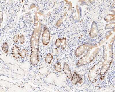 Immunohistochemistry-Paraffin: Cyclin D1 Antibody (SA38-08) [NBP2-67306] - Immunohistochemical analysis of paraffin-embedded human small intestine tissue using anti-Cyclin D1 antibody. The section was pre-treated using heat mediated antigen retrieval with sodium citrate buffer (pH 6.0) for 20 minutes. The tissues were blocked in