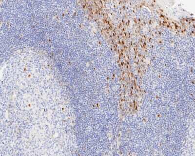 Immunohistochemistry-Paraffin: Cyclin D1 Antibody (SA38-08) [NBP2-67306] - Immunohistochemical analysis of paraffin-embedded human tonsil tissue using anti-Cyclin D1 antibody. The section was pre-treated using heat mediated antigen retrieval with sodium citrate buffer (pH 6.0) for 20 minutes. The tissues were blocked in 5% BSA f