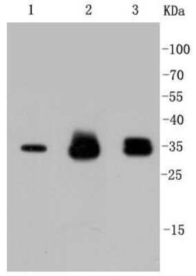 Western Blot: Cyclin D1 Antibody (SA38-08) [NBP2-67306] - Analysis of Cyclin D1 on different lysates using anti-Cyclin D1 antibody at 1/1,000 dilution. Positive control: Lane 1: Hela Lane 2: PC-12 Lane 3: SH-SY-5Y