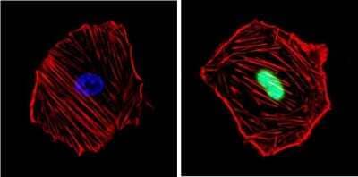 Immunocytochemistry/Immunofluorescence: Cyclin D1 Antibody (SP4) [NB600-584] - Analysis of Cyclin D1/Bcl-1 (green) showing staining in the nucleus of NIH-3T3 cells. Formalin-fixed cells were permeabilized with 0.1% Triton X-100 in TBS for 5-10 minutes and blocked with 3% BSA-PBS for 30 minutes at room temperature. Cells were probed with a Cyclin D1/Bcl-1 monoclonal antibody in 3% BSA-PBS at a dilution of 1:200 and incubated overnight at 4C in a humidified chamber. Cells were washed with PBST and incubated with a DyLight-conjugated secondary antibody in PBS at room temperature in the dark. F-actin (red) was stained with a fluorescent red phalloidin and nuclei (blue) were stained with Hoechst or DAPI.