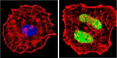 Immunocytochemistry/Immunofluorescence: Cyclin D1 Antibody (SP4) [NB600-584] - Analysis of Cyclin D1/Bcl-1 (green) showing staining in the nucleus of MCF-7 cells. Formalin-fixed cells were permeabilized with 0.1% Triton X-100 in TBS for 5-10 minutes and blocked with 3% BSA-PBS for 30 minutes at room temperature. Cells were probed with a Cyclin D1/Bcl-1 monoclonal antibody in 3% BSA-PBS at a dilution of 1:200 and incubated overnight at 4C in a humidified chamber. Cells were washed with PBST and incubated with a DyLight-conjugated secondary antibody in PBS at room temperature in the dark. F-actin (red) was stained with a fluorescent red phalloidin and nuclei (blue) were stained with Hoechst or DAPI.