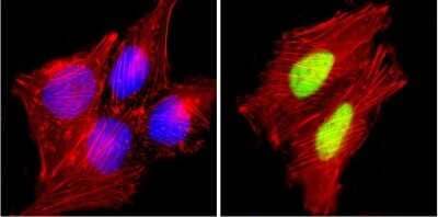 Immunocytochemistry/Immunofluorescence: Cyclin D1 Antibody (SP4) [NB600-584] - Analysis of Cyclin D1/Bcl-1 (green) showing staining in the nucleus of HeLa cells. Formalin-fixed cells were permeabilized with 0.1% Triton X-100 in TBS for 5-10 minutes and blocked with 3% BSA-PBS for 30 minutes at room temperature. Cells were probed with a Cyclin D1/Bcl-1 monoclonal antibody in 3% BSA-PBS at a dilution of 1:200 and incubated overnight at 4C in a humidified chamber. Cells were washed with PBST and incubated with a DyLight-conjugated secondary antibody in PBS at room temperature in the dark. F-actin (red) was stained with a fluorescent red phalloidin and nuclei (blue) were stained with Hoechst or DAPI.