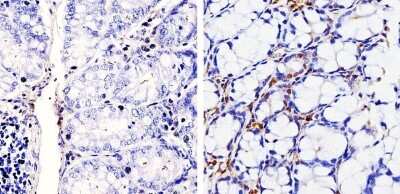 Immunohistochemistry-Paraffin: Cyclin D1 Antibody (SP4) [NB600-584] - Analysis showing staining in the nucleus of paraffin-treated mouse colon tissue (right) compared with a negative control in the absence of primary antibody (left).