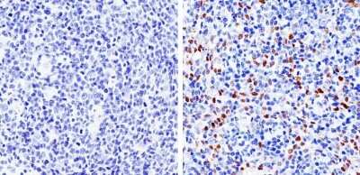 Immunohistochemistry-Paraffin: Cyclin D1 Antibody (SP4) [NB600-584] - Analysis showing staining in the nucleus of human tonsil tissue (right) compared with a negative control in the absence of primary antibody (left).