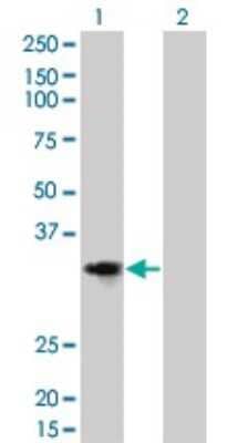 Western Blot: Cyclin D2 Antibody (3B10) [H00000894-M01] - Analysis of CCND2 expression in transfected 293T cell line by CCND2 monoclonal antibody (M01), clone 3B10.Lane 1: CCND2 transfected lysate(33.1 KDa).Lane 2: Non-transfected lysate.