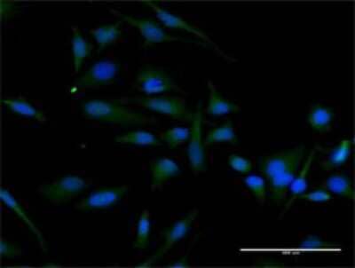 Immunocytochemistry/Immunofluorescence: Cyclin D2 Antibody [H00000894-D01P] - Analysis of antibody to CCND2 on HeLa cell. Antibody concentration 30 ug/ml.