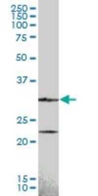 Western Blot: Cyclin D2 Antibody [H00000894-B01P] - Analysis of CCND2 expression in human placenta.