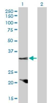 Western Blot: Cyclin D2 Antibody [H00000894-D01P] - Analysis of CCND2 expression in transfected 293T cell line by CCND2 polyclonal antibody.Lane 1: CCND2 transfected lysate(33.10 KDa).Lane 2: Non-transfected lysate.