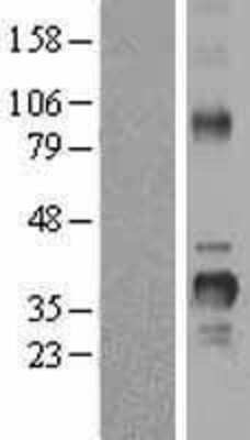 Western Blot: Cyclin D2 Overexpression Lysate (Adult Normal) [NBL1-08872] Left-Empty vector transfected control cell lysate (HEK293 cell lysate); Right -Over-expression Lysate for Cyclin D2.