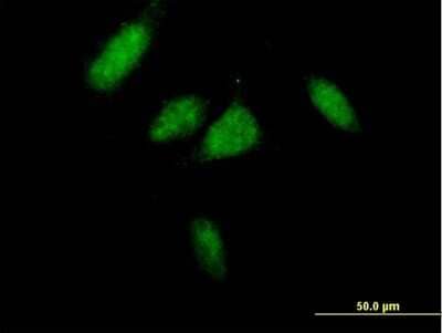 Immunocytochemistry/Immunofluorescence: Cyclin D3 Antibody [H00000896-B01P] - Analysis of purified antibody to CCND3 on HeLa cell. (antibody concentration 7 ug/ml)