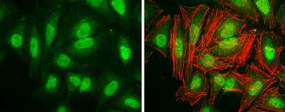 Immunocytochemistry/Immunofluorescence: Cyclin D3 Antibody [NBP1-31806] - HeLa cells were fixed in 4% paraformaldehyde at RT for 15 min. Green: Cyclin D3 protein stained by Cyclin D3 antibody  diluted at 1:200. Red: phalloidin, a cytoskeleton marker, diluted at 1:50.