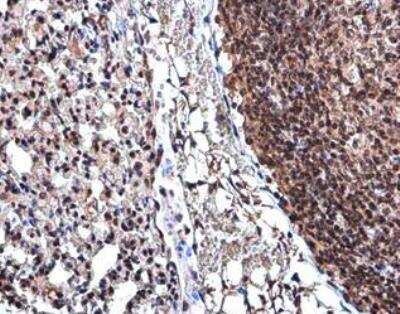 Immunohistochemistry-Paraffin: Cyclin D3 Antibody [NBP1-31806] - Paraffin-embedded mouse lung. Cyclin D3 antibody  diluted at 1:500.