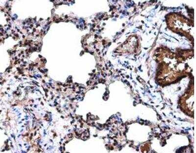 Immunohistochemistry-Paraffin: Cyclin D3 Antibody [NBP1-31806] - Rat lung.  Cyclin D3 antibody diluted at 1:500. Antigen Retrieval: Citrate buffer, pH 6.0, 15 min