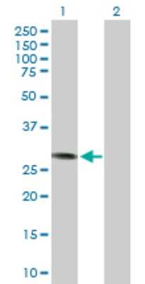 Western Blot: Cyclin D3 Antibody [H00000896-D01P] - Analysis of CCND3 expression in transfected 293T cell line by CCND3 polyclonal antibody.Lane 1: CCND3 transfected lysate(32.50 KDa).Lane 2: Non-transfected lysate.