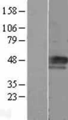 Western Blot Cyclin E1 Overexpression Lysate