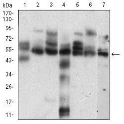 Western Blot: Cyclin E1 Antibody (5F8C5) [NBP2-37247] - Western blot analysis using CCNE1 mouse mAb against Hela (1), K562 (2), NIH/3T3 (3), C6 (4), MCF-7 (5), Jurkat (6), A431 (7) cell lysate.